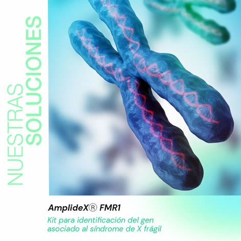 🔬 AmplideX® PCR/CE FMR1: tecnología avanzada para el diagnóstico del síndrome de X frágil