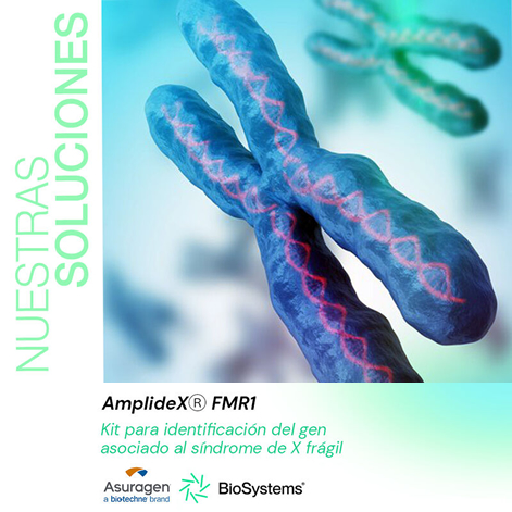 AmplideX® PCR/CE FMR1: tecnología avanzada para el diagnóstico del síndrome de X frágil